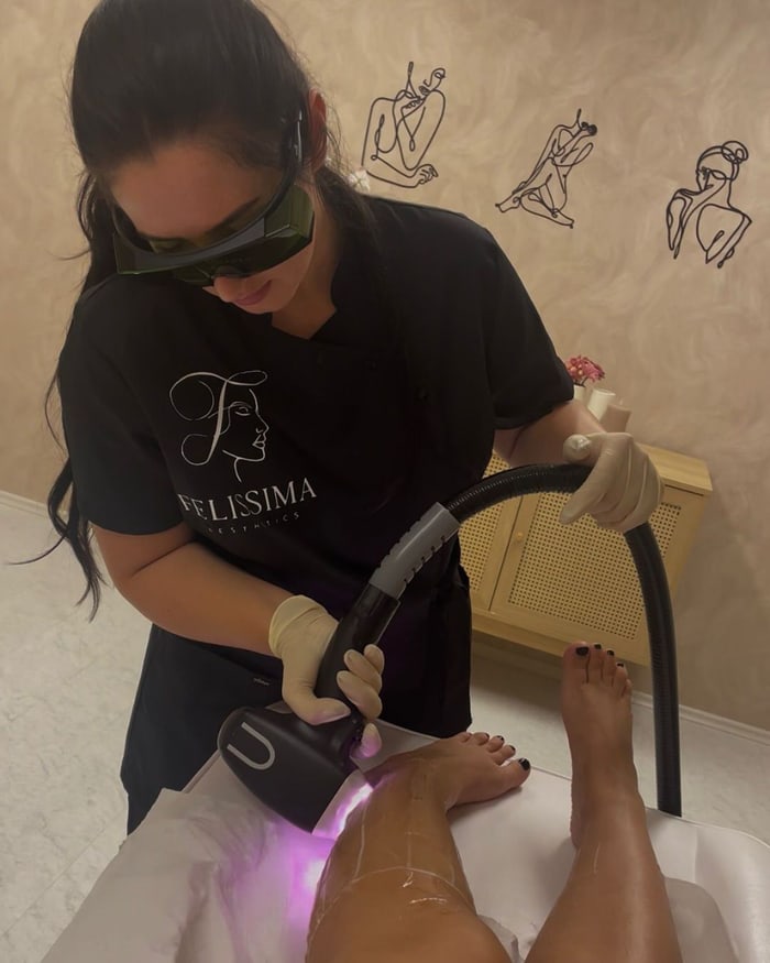 Laserbehandlung im Studio von Felissima Aesthetics